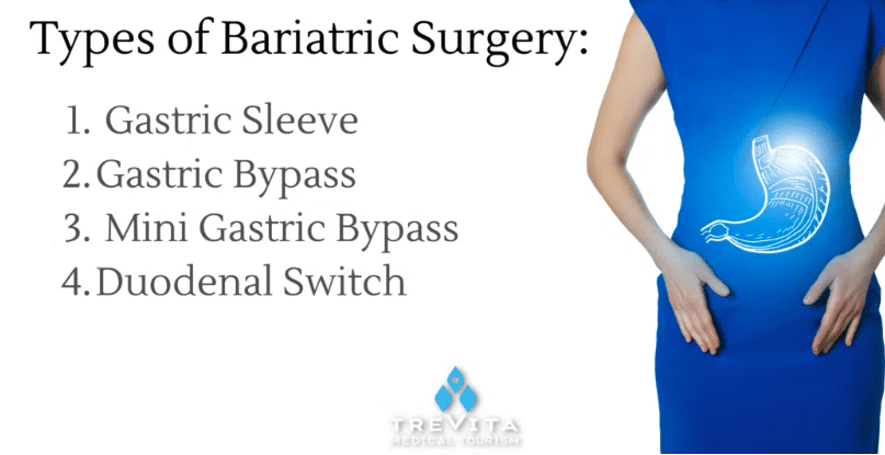 types of bariatric surgery