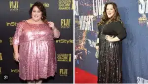 Chrissy Metz before and after weight loss surgery 