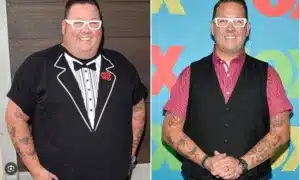 Graham Elliot before and after weight loss surgery 