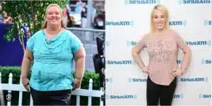 Mama June Shannon before and after weight loss surgery 