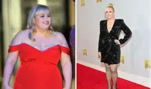 Rebel Wilson before and after weight loss surgery 