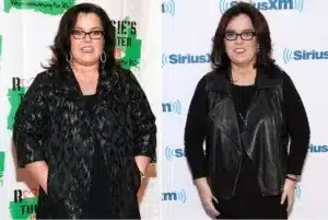 Rosie O’Donnell before and after weight loss surgery 