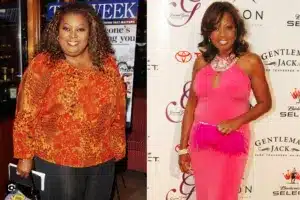 Star Jones before and after weight loss surgery 