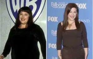 Carnie Wilson before and after weight loss surgery 