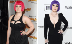 Kelly Osbourne before and after weight loss surgery 