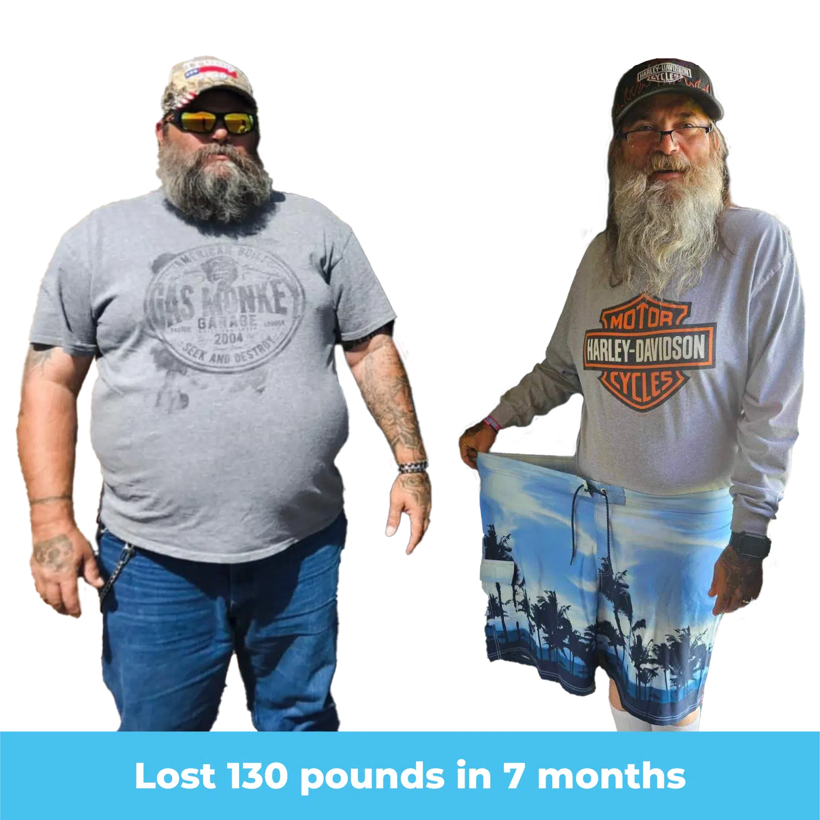 Side-by-side images of Eli before and after his bariatric surgery, showcasing his significant weight loss and transformation.