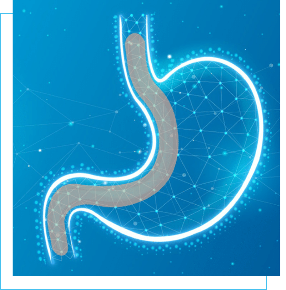 gastric sleeve illustration with blue frame offset